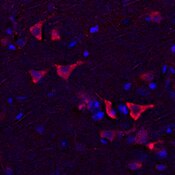 Immunofluorescent image of a human brain labeled with DSHB antibody Anti-ASIC4 [BCN315.1.1F9] against Acid-sensing ion channel 4 (red). Image Credit: BICCN.